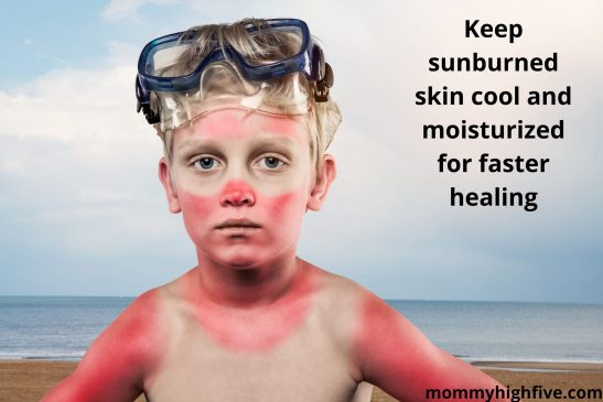 Sunburn treatment for kids